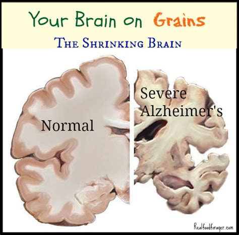 Grain Brain, Eating Fat Makes You Smart | Peppy and Trimly Fit