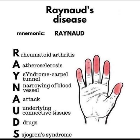 RAYNAUD'S DISEASE - MEDizzy