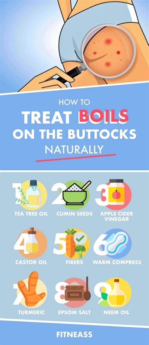 How To Treat Boils On The Buttocks With Natural Remedies - Fitneass