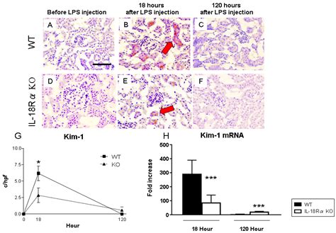 IJMS | Free Full-Text | Lipopolysaccharide-Induced Acute Kidney Injury ...