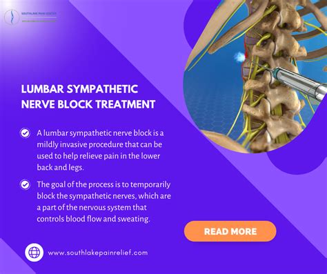 Lumbar Sympathetic Nerve Block Treatment in Southlake, TX – South Lake Pain Center – Pain ...