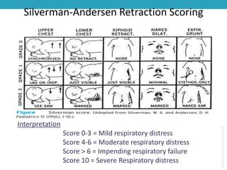 Respiratory distress in newborn | PPT