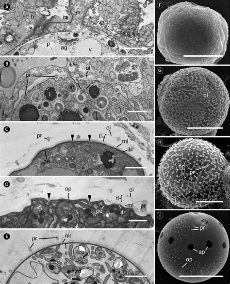 Transmission Electron Microscopy Cell