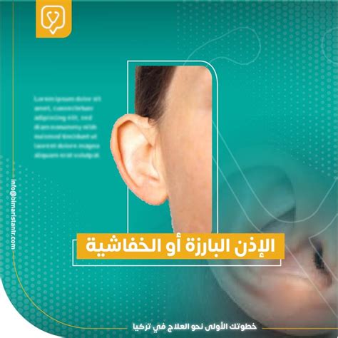 Bat ear treatment without surgery - prominent ear aesthetics