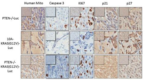 Immunohistochemistry of proliferative and cell cycle arrest markers in ...