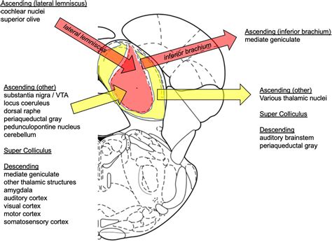 Inferior Colliculus Mri