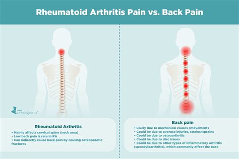 Causes of Rheumatoid Arthritis Pain Aside from Inflammation