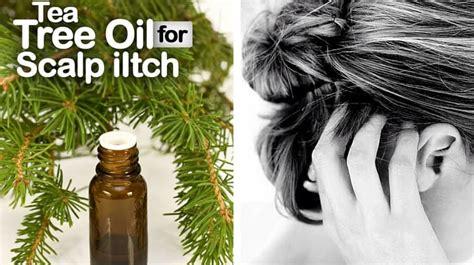 How to Get Rid of Itchy Scalp with Tea Tree Oil