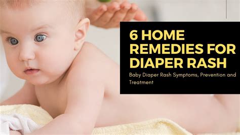 6 home remedies for diaper rash in Babies| Baby Diaper Rash Symptoms, Prevention and Treatment ...