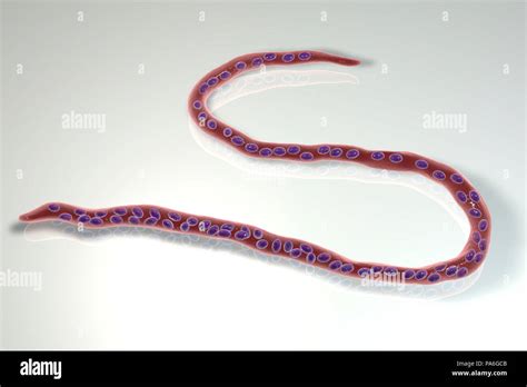 Onchocerca volvulus worms hi-res stock photography and images - Alamy