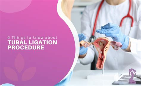 6 Things to know about Tubal Ligation Procedure