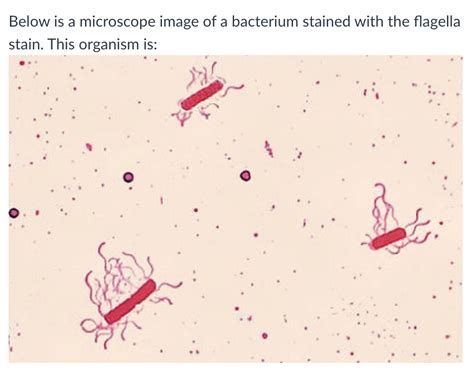 Solved Bacterial flagella are too thin to be viewed with the | Chegg.com