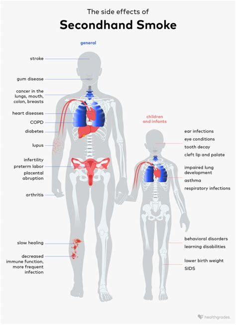 Effects of Secondhand Smoke: Dangers, Prevention, and More