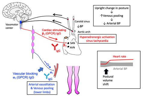 autonomic_dysfunction_pathophysiology [TUSOM | Pharmwiki]