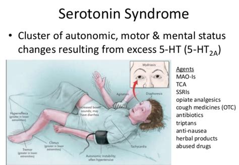 Serotonin Syndrome - Causes, Signs, Symptoms, Duration, Treatment