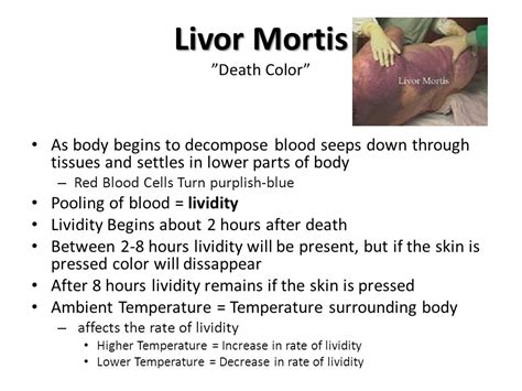 Livor Mortis Stages