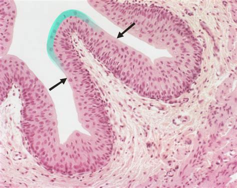 Glandular Epithelium Tissue