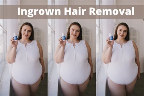 5 Incredible Ingrown Hair Removal Products for Models - How To Become A Plus Size Model