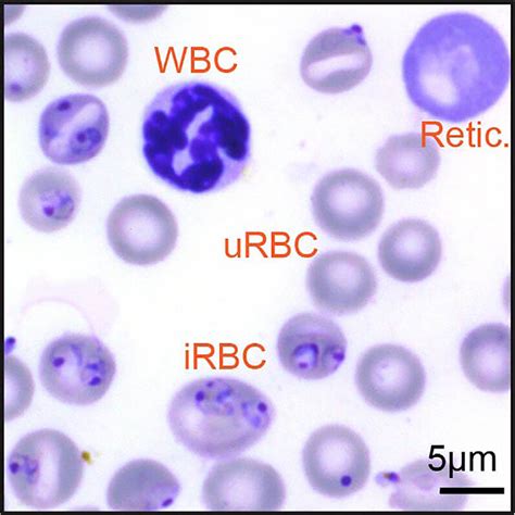 Giemsa-stained blood smear from Pccinfected mouse | Download Scientific Diagram