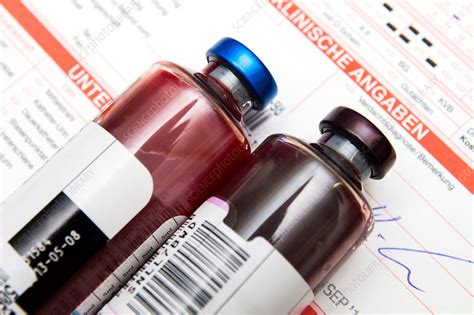 Blood culture bottles - Stock Image - C036/6660 - Science Photo Library