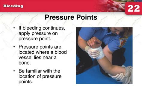 PPT - 22: Bleeding PowerPoint Presentation, free download - ID:204031