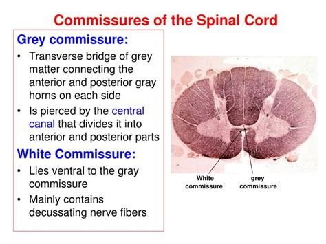 PPT - Anatomy of the Spinal Cord PowerPoint Presentation - ID:1795722