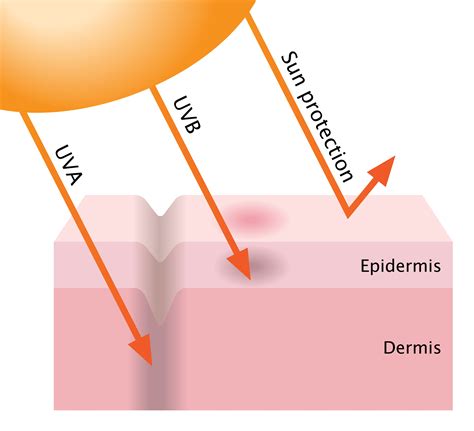 How Sunburns Can Damage Your Skin - Fullerton, CA