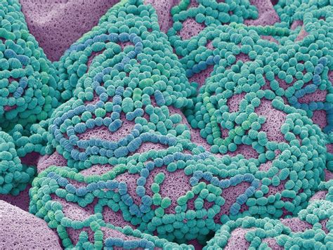 Tooth bacteria, SEM - Stock Image - C037/1241 - Science Photo Library | Scanning electron ...