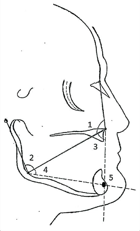 Reconstruction of point Gnathion | Download Scientific Diagram