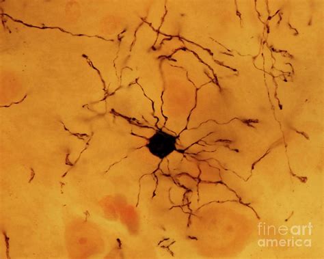 Oligodendroglia Photograph by Jose Calvo / Science Photo Library | Pixels