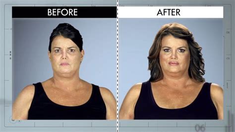 Flat Face from Botched Patients Before and After: Shocking Transformations! | E! News