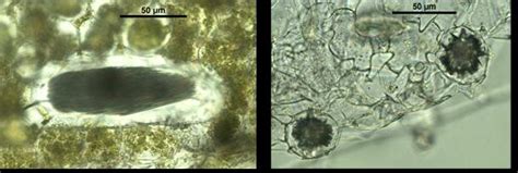 a. Idioblast of D. nivosum from leaf; b. Druse of D. nivosum from leaf. | Download Scientific ...