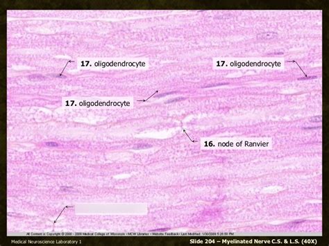 Medullated Nerve Fiber Diagram | Quizlet