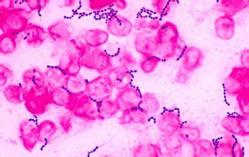 Enterococcus faecalis