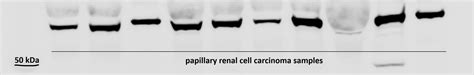 HIF-3 alpha Antibody (NB100-2529): Novus Biologicals