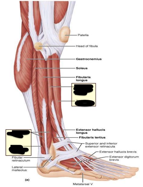 Lab practical- side of shin muscles Diagram | Quizlet