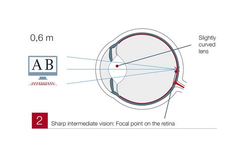 Presbyopia - Correction & Treatment at Test Winner EuroEyes