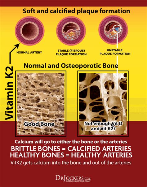 3 Major Benefits of Vitamin K2 For Your Heart and Bones