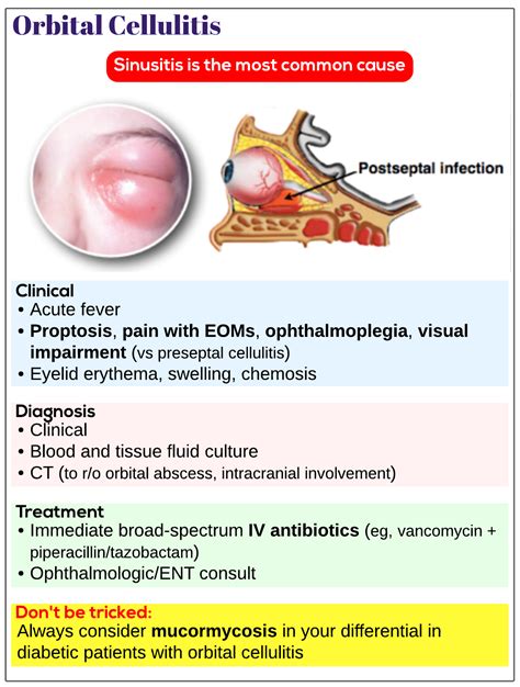 Orbital Cellulitis Adult Treatment