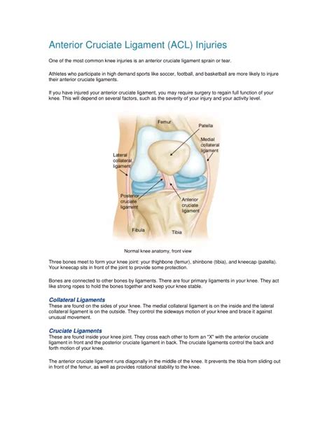 PPT - Anterior Cruciate Ligament (ACL) Injuries Surgery pdf | Shri ...