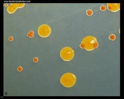 Chryseobacterium indologenes - microbewiki