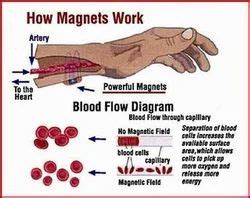 Magnet Therapy in India