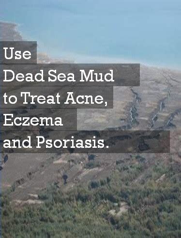 5 Popular Dead Sea Mud Mask Benefits - Skin Disease Remedies