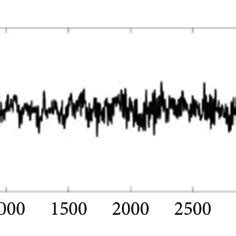 Sample of EEG signal from Bonn University dataset. (a) Class Z, (b ...