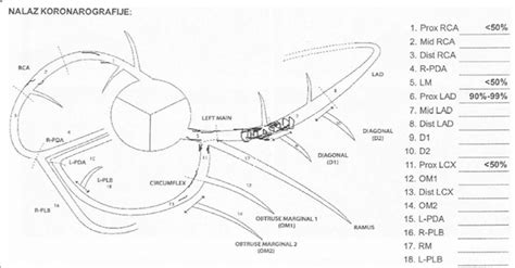 Scheme of coronary angiogram showed stenosis of coronary arteries.... | Download Scientific Diagram