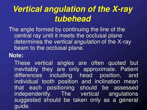 Bisecting angle technique