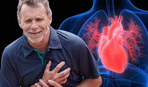 Heart attack: ‘Early’ symptoms include dyspnea or shortness of breath - doctor | Express.co.uk