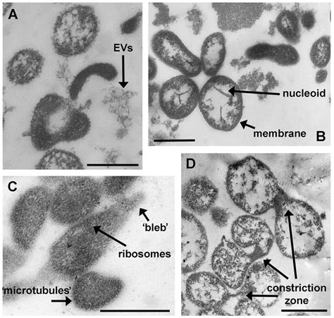 Transmission electron microscopy images of the minimal prokaryotic ...