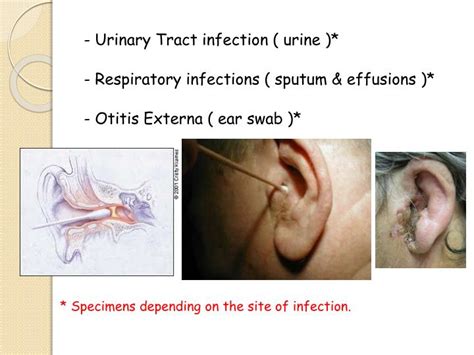 PPT - Pseudomonas PowerPoint Presentation - ID:2269529