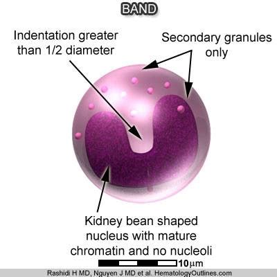 Band neutrophil or Staff Cell | Medical Laboratories